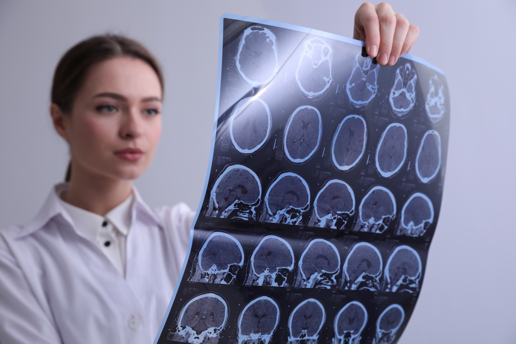 Alzheimerova choroba